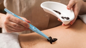 En M&eacute;xico no se usan las sanguijuelas por prejuicios: m&eacute;dico