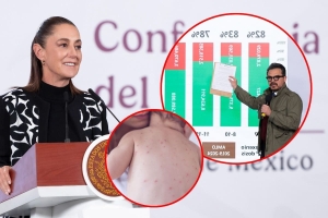 Sheinbaum llama a &ldquo;guardar la calma&rdquo; ante brote de Sarampi&oacute;n en el pa&iacute;s; hay suficiente vacuna, dice