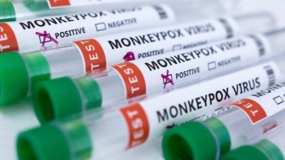 EU declarará emergencia sanitaria nacional por la viruela del mono