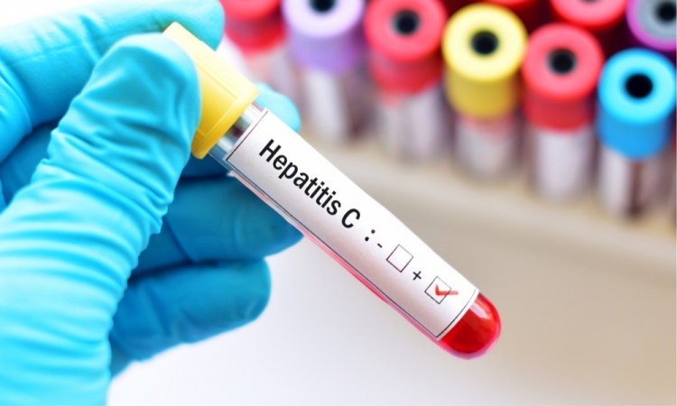 Cada minuto y medio una persona fallece por hepatitis: IMSS