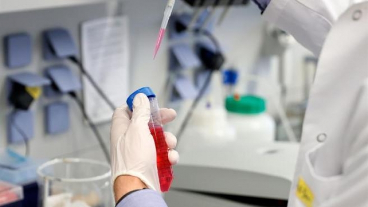 Oxford continuará con ensayos de vacuna covid pese a muerte de voluntario