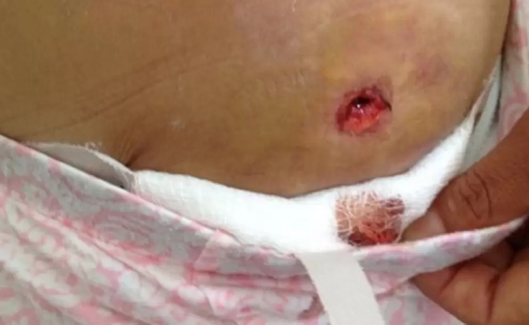 Ingresa joven herido de bala a hospital