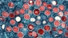 La Viruela del Mono cambiar&aacute; de nombre a "mpox" tras m&aacute;s de 81 mil casos en todo el mundo: OMS