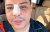 Eduin Caz de Grupo Firme alarma a sus fans al aparecer con moretones en la cara en video mientras cancela concierto