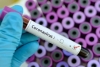 Ya hay 18 millones de personas en cuarentena por coronavirus