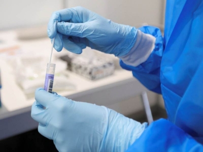 Canad&aacute; confirma los primeros 2 casos de variante &Oacute;micron